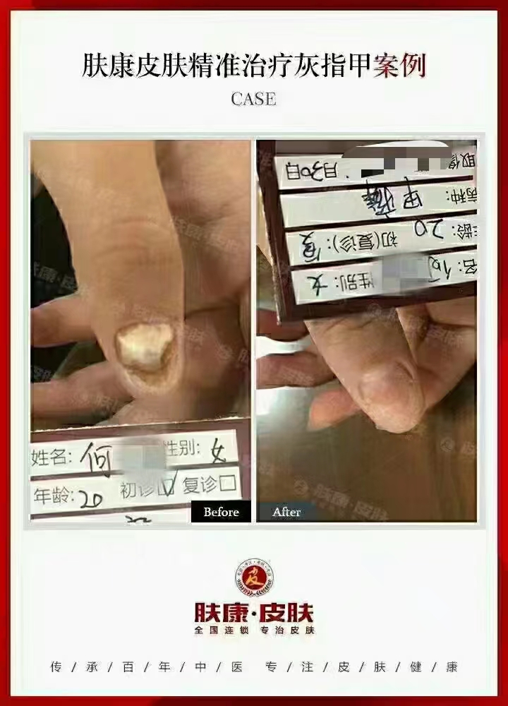 [֣ݷƤר]ָƿԱͼ·20230610