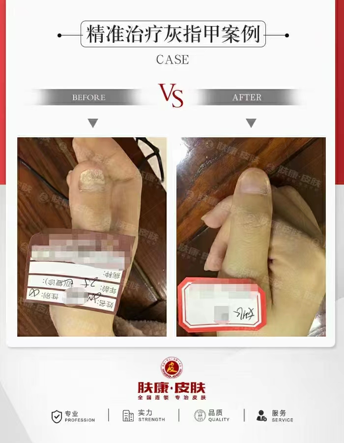 [֣ݷƤר]ָƿԱͼ·20230610