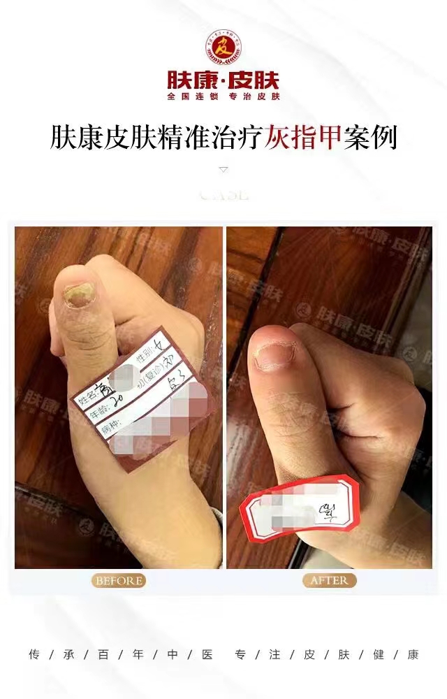 [֣ݷƤר]ָƿԱͼ·20230610