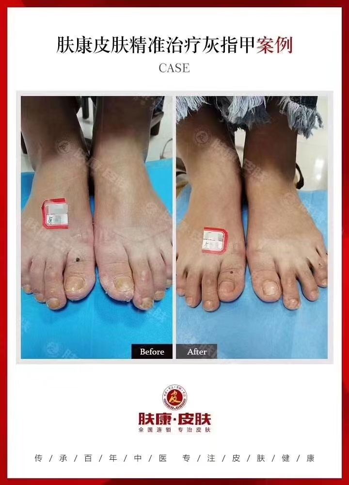 [֣ݷƤר]ָƿԱͼ·20230610