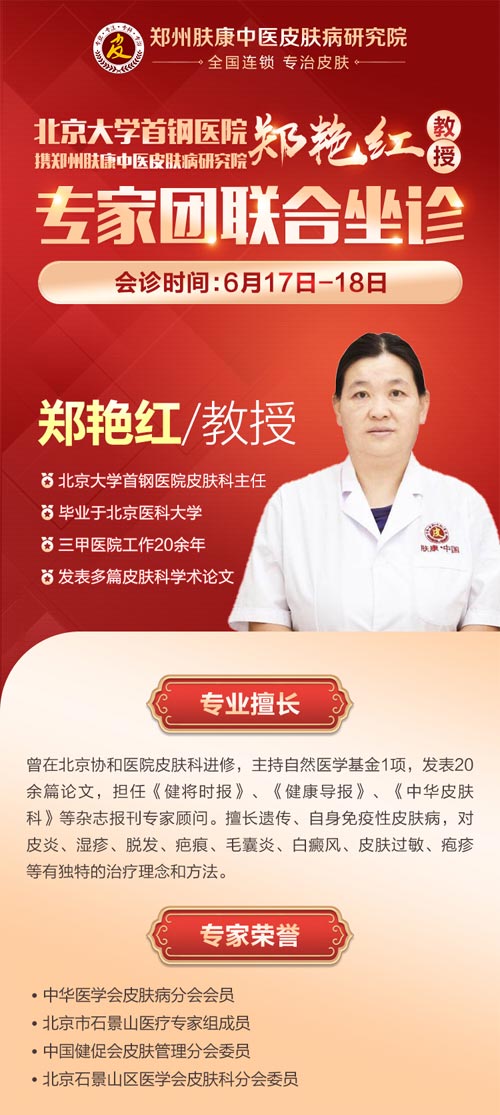 通知:6月17至18两天郑州肤康特邀郑艳红教授联合会诊